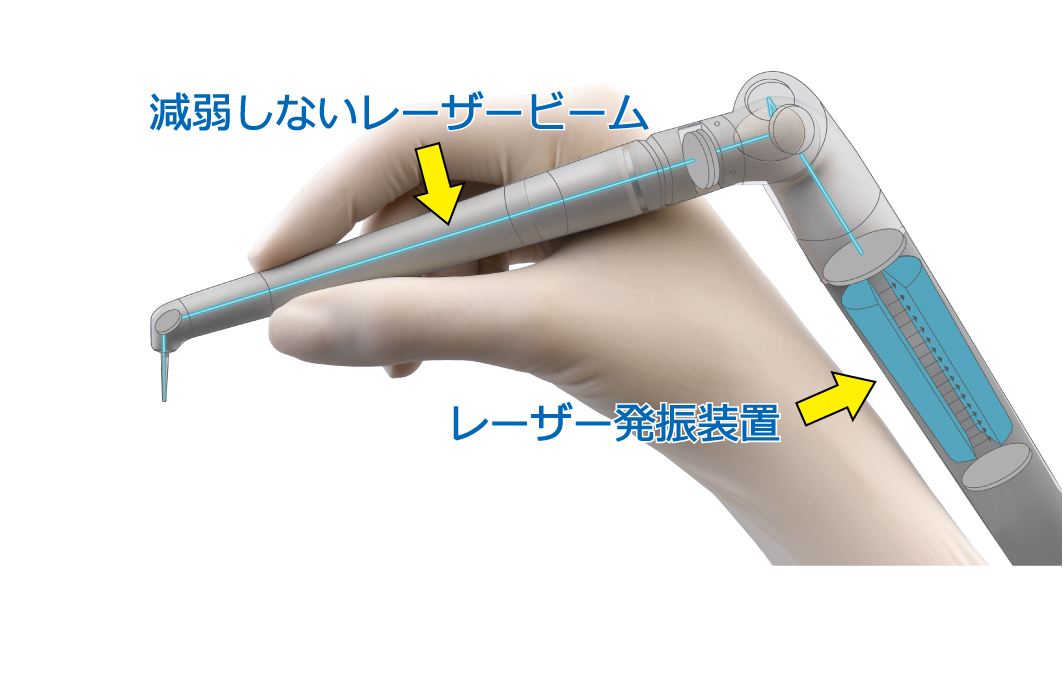 エルビウムヤグ(Er:YAG)ライトタッチレーザー切削力